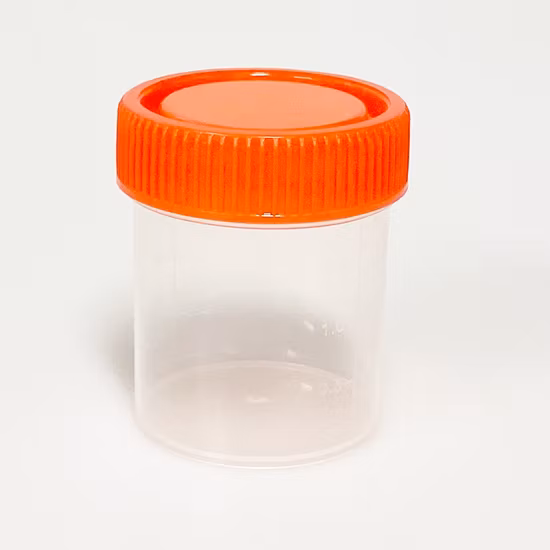 90ml Sterile Vacuum Urine Specimen Sample Collection Cup Test Container